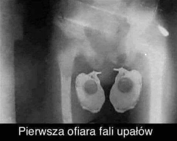 uapł